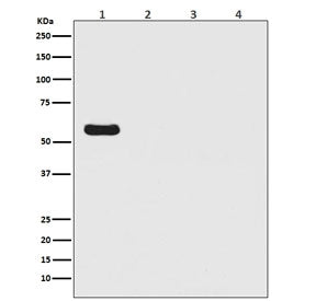 Firefly Luciferase Antibody