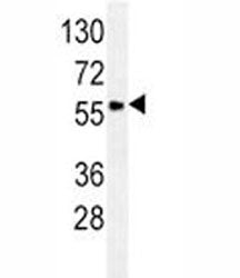 GCET1 Antibody / SERPINA9, 0.08ml