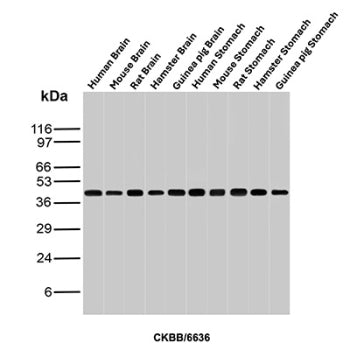 Western blot analysis of Human Brain, Mouse Brain, Rat Brain, Hamster Brain, Guinea pig Brain, Human
