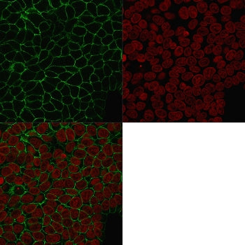 Immunofluorescent staining of human MCF7 cells with EpCAM antibody (clone HEA125, green) and Reddot