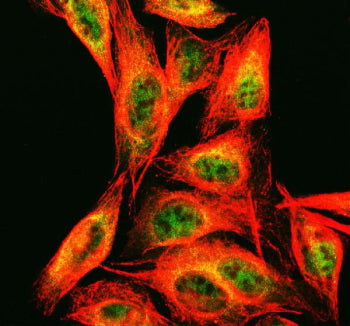 Immunofluorescent staining of FFPE human U-2 OS cells with ECD antibody (green) and Alpha Tubulin mA