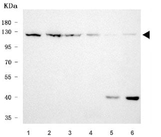 Western blot testing of 1) human HeLa, 2) human MOLT4, 3) human 293T, 4) human A431, 5) rat brain an