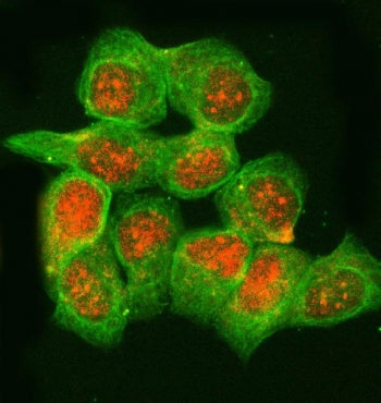 Immunofluorescent staining of FFPE human T-47D cells with RNase H2 subunit B antibody (red) and Alph