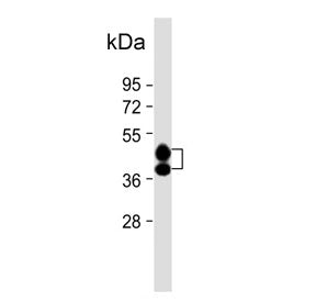 Western blot testing of human liver tissue lysate with Haptoglobin antibody. Predicted molecular wei