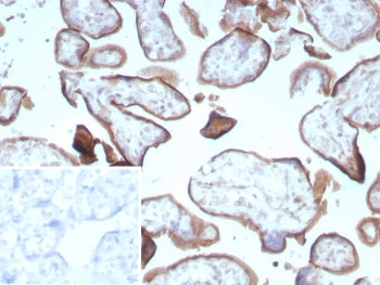 IHC staining of FFPE human placental tissue with Endoglin / CD105 antibody (clone ENG/8961R) Inset: