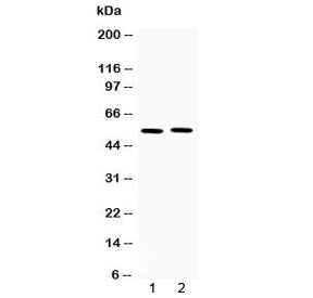 MMP11 Antibody