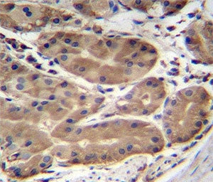 ABHD2 antibody immunohistochemistry analysis in formalin fixed and paraffin embedded human stomach t