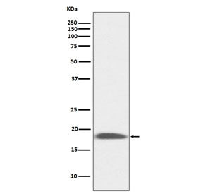 Western blot testing of mouse kidney lysate with Sca-1 antibody. Expected molecular weight: 14-18 kD