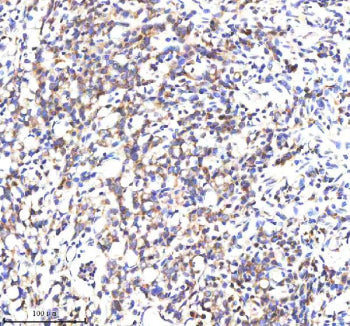 IHC analysis of SCNM1 using anti-SCNM1 antibody. SCNM1 was detected in a paraffin-embedded section o