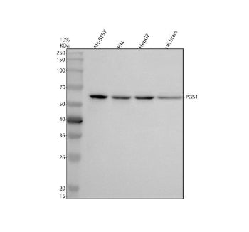 Western blot analysis of PGS1 using anti-PGS1 antibody. Electrophoresis was performed on a 10% SDS-P