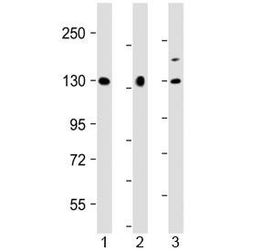 Western blot testing of human 1) U-87 MG, 2) HeLa and 3) BxPC-3 cell lysate with MGEA5 antibody at 1