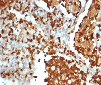 IHC staining of FFPE human lung tissue with S100G antibody (clone S100G/7462). HIER: boil tissue sec