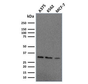 RPA32 Antibody / Replication Protein A2