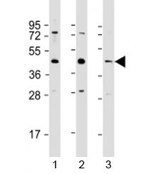 G6PC3 Antibody / Glucose-6-phosphatase 3