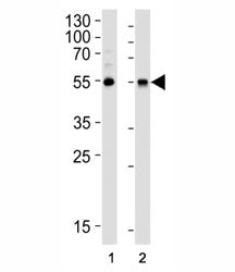 Western blot analysis of lysate from (1) HepG2 cell line and (2) human lung tissue lysate using ALDH