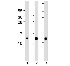 Western blot testing of human 1) SH-SY5Y, 2) A431 and 3) HeLa cell lysate with Thioredoxin antibody