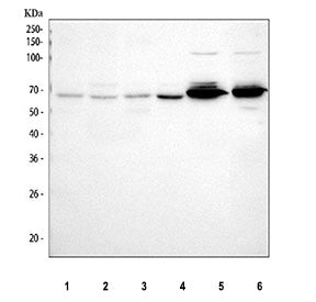 Western blot testing of human 1) SW620 and 2) MCF7 cell lysate with PTGER4 antibody at 0.5ug/ml. Pre