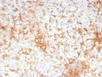 IHC staining of FFPE human adrenal gland tissue with Adipose differentiation-related protein antibod