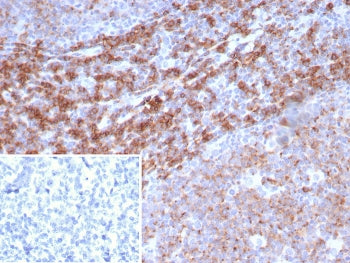 IHC staining of FFPE human tonsil tissue with CD39 antibody (clone CD39/8162R). Inset: PBS used in p