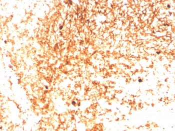 IHC staining of FFPE human tonsil with recombinant IgM antibody (clone IGHM/3803R). HIER: boil tissu