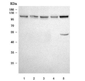 Western blot testing of 1) human SH-SY5Y, 2) human U-87 MG, 3) human U-251, 4) human SK-N-SH and 5)