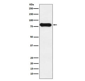 Western blot testing of human tonsil lysate with IgD antibody. Expected molecular weight ~64 kDa but