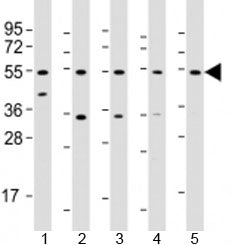 Western blot testing of human 1) liver, 2) HeLa, 3) PC-3, 4) SK-BR-3 and 5) TT cell lysate with THRB