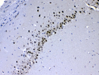 CHD2 Antibody / Chromodomain-helicase-DNA-binding protein 2