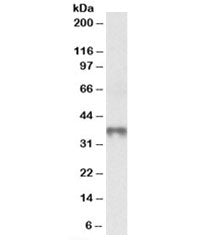 Western blot testing of human thymus lysate with MAT2B antibody at 0.3ug/ml. Predicted molecular wei