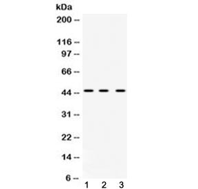 Western blot testing of 1) rat liver, 2) mouse spleen and 3) human HeLa cell lysate with hnRNP F ant