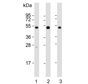 Western blot testing of 1) human brain, 2) mouse brain and 3) rat brain lysate with NPTX1 antibody.
