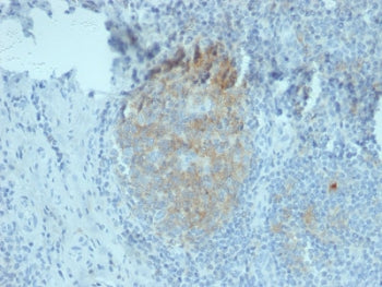 IHC staining of FFPE human tonsil tissue with CD80 antibody (clone C80/2776). HIER: boil tissue sect