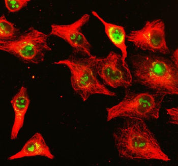 Immunofluorescent staining of NUP85 using anti-NUP85 antibody (green) and anti-Beta Tubulin antibody