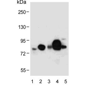 Western blot testing of human 1) A549, 2) plasma, 3) fetal kidney, 4) breast and 5) uterus lysate wi
