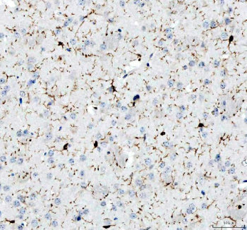 IHC testing of FFPE human spleen tissue with IBA1 antibody. Required HIER: steam section in pH8 EDTA