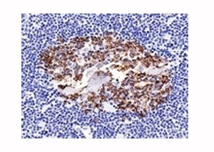 IHC analysis of formalin-fixed, paraffin-embedded normal human spleen stained with CDw75 antibody (c