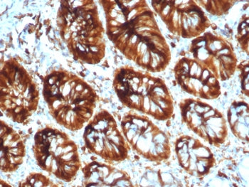 STMN1 Antibody / Stathmin 1