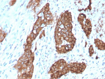 PDLIM1 Antibody