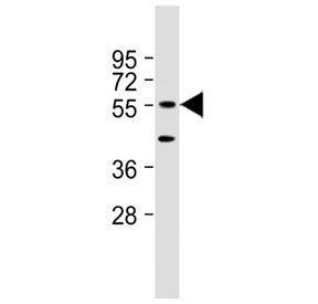 Western blot testing of mouse NIH3T3 cell lysate with DNAJC3 antibody at 1:2000. Predicted molecular