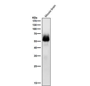Western blot testing of mouse brain tissue lysate with Phospho-Chk2 (Ser33/Ser35) antibody at 1:1000