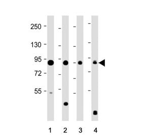 Western blot testing of 1) human brain, 2) mouse brain, 3) rat brain and 4) TT cell lysate with DCAM