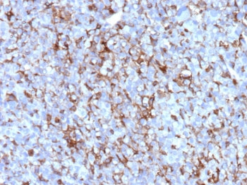 IHC staining of FFPE human adrenal gland tissue with Clusterin antibody (clone CLU/12058). HIER: boi