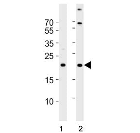 Western blot testing of human 1) MCF7 and 2) A431 cell lysate with TIMM23 antibody. Predicted molecu