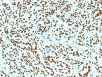 IHC testing of FFPE human pancreas and recombinant Histone H1 antibody (clone HH1/1784R). Required H