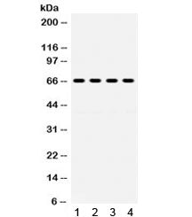 GRK6 Antibody