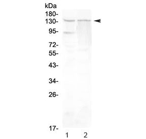 RTEL1 Antibody
