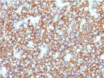 IHC testing of recombinant CD20 antibody and FFPE human tonsil tissue. HIER: steam section in pH 9 1