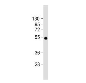 Western blot testing of mouse lung tissue lysate with SLC29A1 antibody. Predicted molecular weight ~