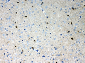 HCN2 Antibody