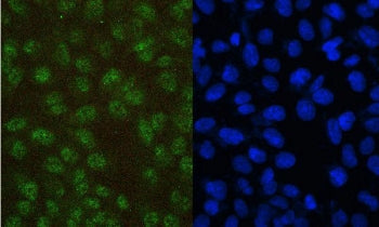 Immunofluorescent staining of FFPE human U-2 OS cells with PAX5 antibody (green) and DAPI (blue). HI